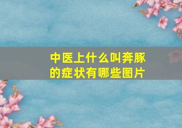 中医上什么叫奔豚的症状有哪些图片