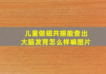 儿童做磁共振能查出大脑发育怎么样嘛图片