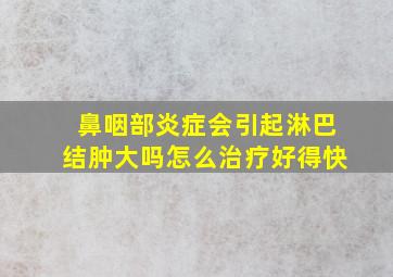 鼻咽部炎症会引起淋巴结肿大吗怎么治疗好得快