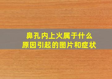 鼻孔内上火属于什么原因引起的图片和症状